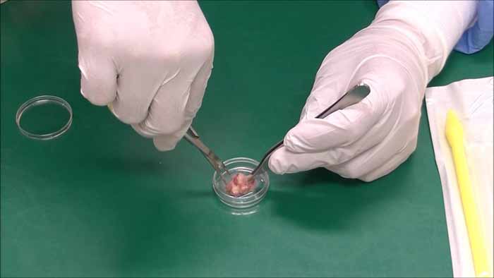 10mm3程度の腫瘍組織片を細かく細切します。
