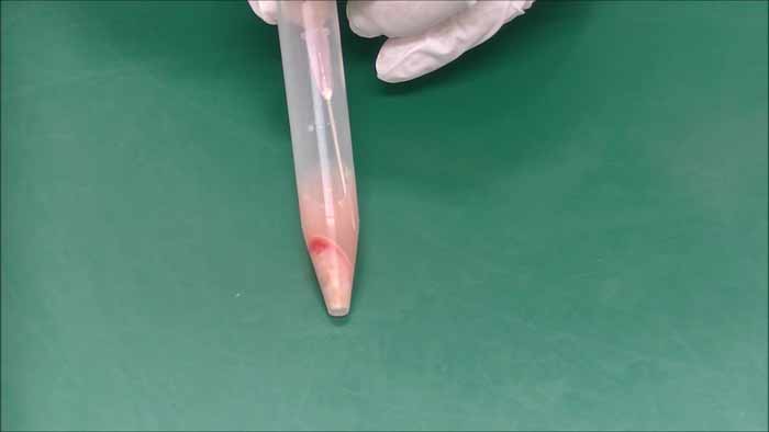 付属のルアーロックシリンジに針を回しながら緩みのないようにつけ、細胞破砕残渣を吸わないようにできるだけ上澄みを2.5ml採取する(細胞破砕抗原液)
